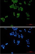 UBE2L3 Recombinant Rabbit Monoclonal Antibody