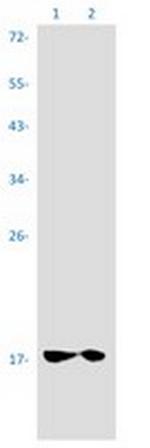 UBE2L3 Antibody in Western Blot (WB)