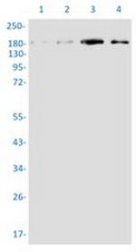 TSC2 Recombinant Rabbit Monoclonal Antibody