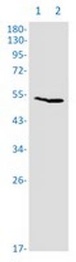 WARS1 Recombinant Rabbit Monoclonal Antibody