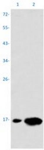 TRAPPC2 Recombinant Rabbit Monoclonal Antibody