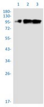 TPX2 Recombinant Rabbit Monoclonal Antibody
