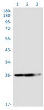 TPMT Recombinant Rabbit Monoclonal Antibody