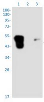 TFPI Recombinant Rabbit Monoclonal Antibody