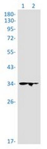 GTF2B Recombinant Rabbit Monoclonal Antibody
