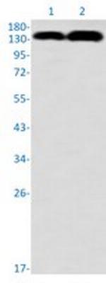 GTF2I Antibody in Western Blot (WB)
