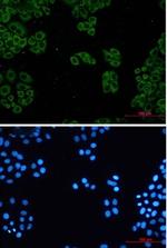 TCP1 Recombinant Rabbit Monoclonal Antibody