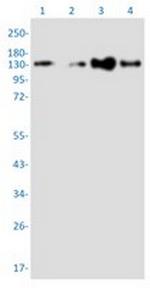 TACC3 Recombinant Rabbit Monoclonal Antibody