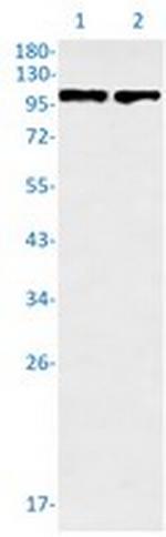 STAT6 Antibody in Western Blot (WB)