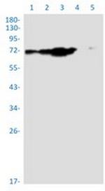 SNX1 Antibody in Western Blot (WB)