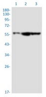 SMARCD1 Recombinant Rabbit Monoclonal Antibody