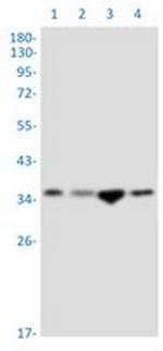 SRR Recombinant Rabbit Monoclonal Antibody