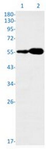 SEPTIN8 Recombinant Rabbit Monoclonal Antibody