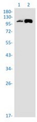 SEC24D Recombinant Rabbit Monoclonal Antibody