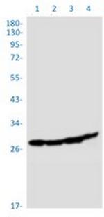 SBDS Antibody in Western Blot (WB)