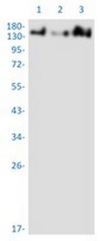 ZFYVE9 Recombinant Rabbit Monoclonal Antibody