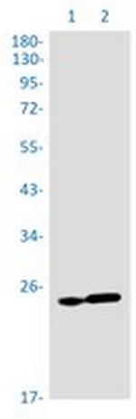 RPS8 Recombinant Rabbit Monoclonal Antibody