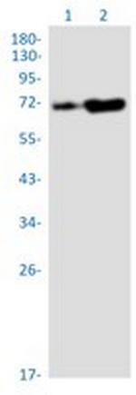 RPA1 Recombinant Rabbit Monoclonal Antibody