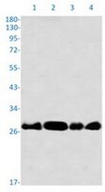 RPA2 Recombinant Rabbit Monoclonal Antibody