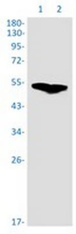 RNF14 Recombinant Rabbit Monoclonal Antibody