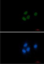 RCC1 Recombinant Rabbit Monoclonal Antibody