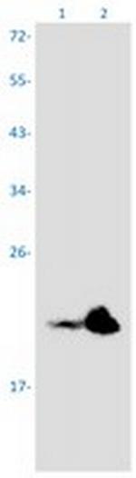 NRAS Recombinant Rabbit Monoclonal Antibody