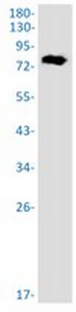 RANGAP1 Antibody in Western Blot (WB)