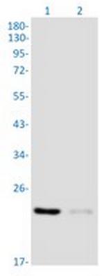 RAB29 Recombinant Rabbit Monoclonal Antibody