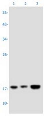 PTP4A2 Recombinant Rabbit Monoclonal Antibody