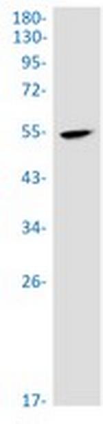 PPP2R5E Antibody in Western Blot (WB)