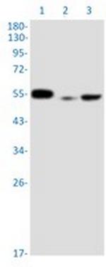 PPP2R5E Antibody in Western Blot (WB)