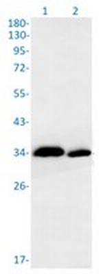 PPCS Recombinant Rabbit Monoclonal Antibody