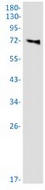 PREPL Recombinant Rabbit Monoclonal Antibody