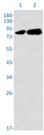 PRKCQ Recombinant Rabbit Monoclonal Antibody