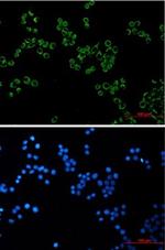 PRDX3 Recombinant Rabbit Monoclonal Antibody