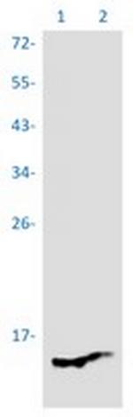 PSENEN Recombinant Rabbit Monoclonal Antibody
