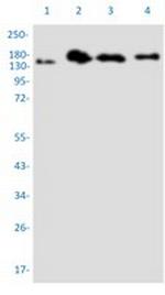 PELP1 Recombinant Rabbit Monoclonal Antibody
