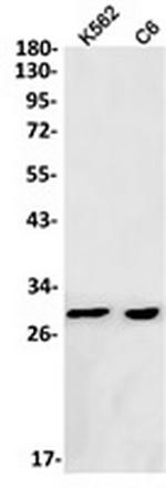 ANP32B Antibody in Western Blot (WB)