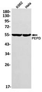 PEPD Recombinant Rabbit Monoclonal Antibody