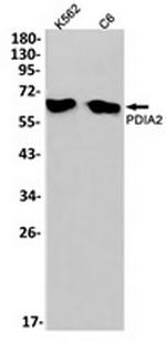 P4HB Recombinant Rabbit Monoclonal Antibody
