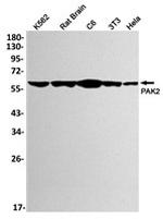 PAK2 Recombinant Rabbit Monoclonal Antibody