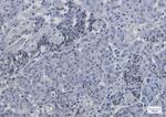 Phospho-CDKN1B (Ser10) Recombinant Rabbit Monoclonal Antibody