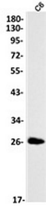 Phospho-CDKN1B (Ser10) Antibody in Western Blot (WB)