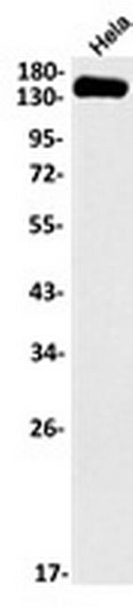 HYOU1 Recombinant Rabbit Monoclonal Antibody