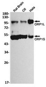 OSBPL1A Recombinant Rabbit Monoclonal Antibody