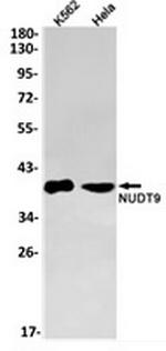 NUDT9 Antibody in Western Blot (WB)