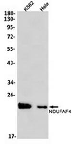 NDUFAF4 Recombinant Rabbit Monoclonal Antibody