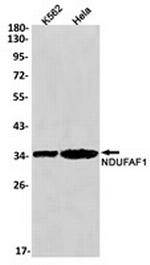 NDUFAF1 Recombinant Rabbit Monoclonal Antibody