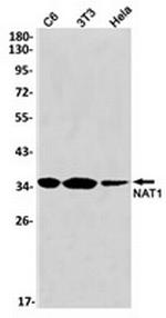 NAT1 Recombinant Rabbit Monoclonal Antibody