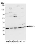 RAB10 Antibody in Western Blot (WB)